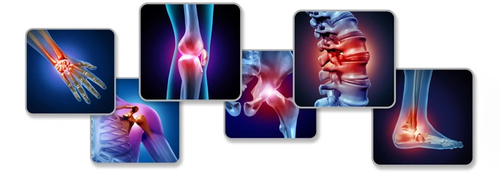 A collage of medical illustrations highlighting joint pain in areas such as the wrist, knee, hip, spine, shoulder, and ankle.